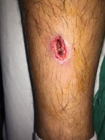 Esnaf dayağından sonra Belediye'nin tesisinde dayak skandalı!