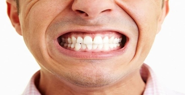 Diş Sıkma (Bruksizm) Tedavisi