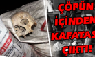Çöp Konteynerinde Kafatası Bulundu!